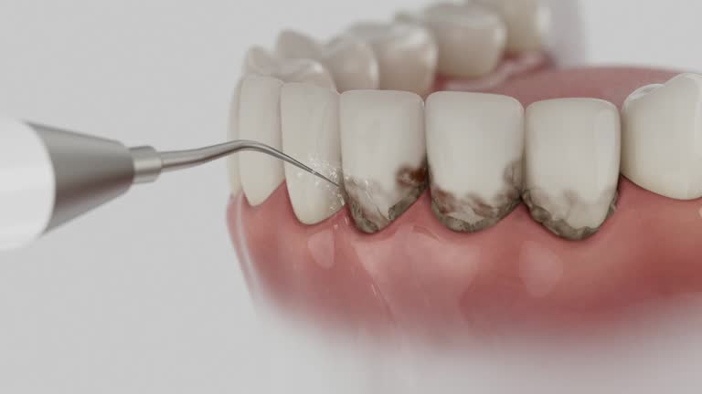 Trusted Wisdom Tooth Removal service in Fredericksburg, VA - Dentist Open Now